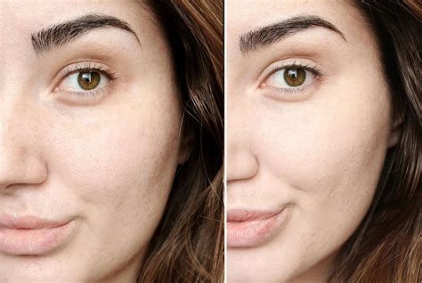 which chanel foundation is best for me|Chanel foundation before and after.